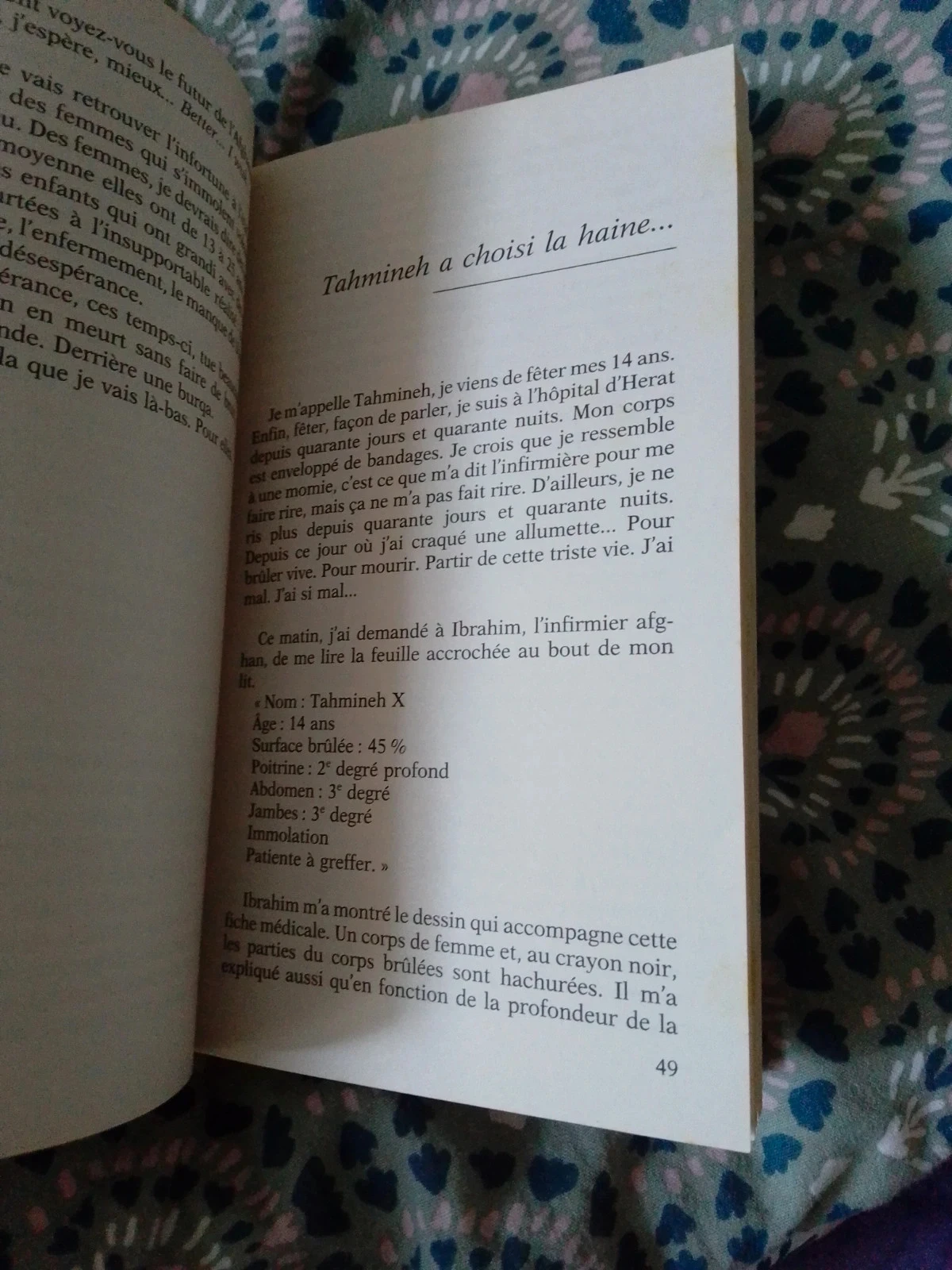 S'immoler à 20 ans. Afghanistan – photo 5
